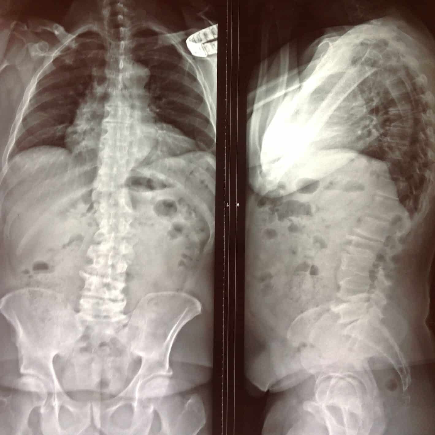 colonne degenerative Cabinet Spin'Dynamic